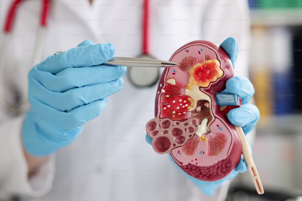 Urología en Clínica Hispana Nueva Salud Rampart en Houston