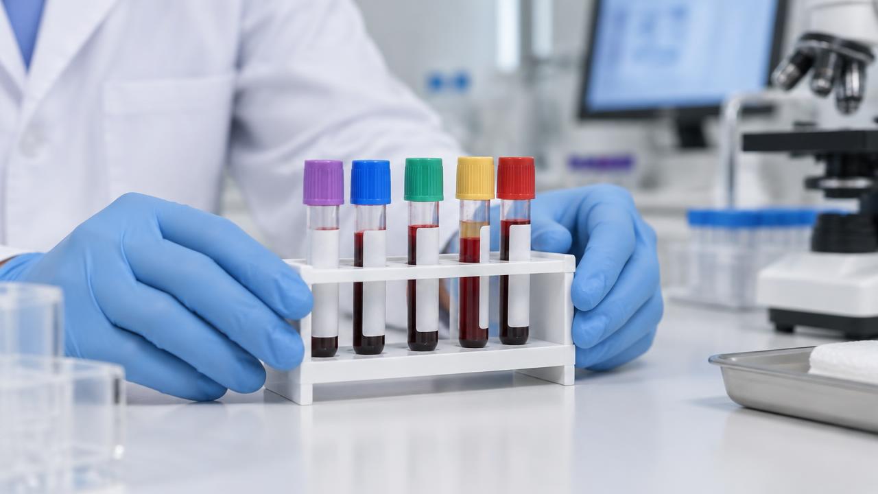 Muestras de sangre preparadas para medir glucosa, electrolitos y otros componentes de un panel metabólico completo.