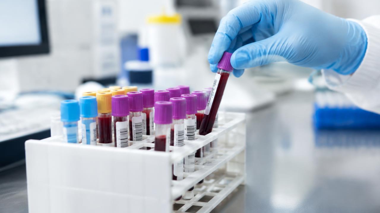 Tubos con muestras de sangre en una gradilla de laboratorio, preparados para su análisis.