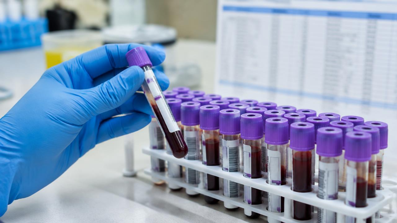Revisión de los valores de referencia en un análisis de sangre